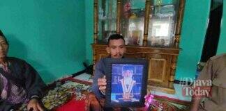 Bocah SD Tersambar Petir