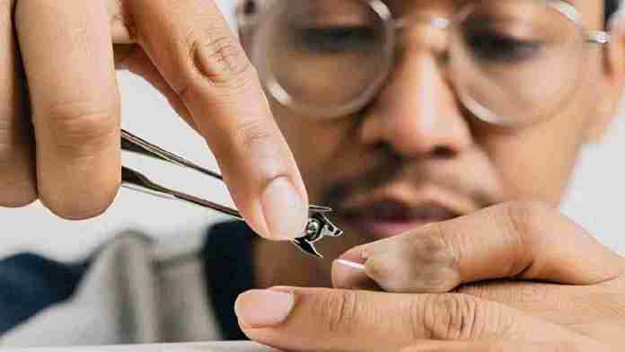 Akibat Tidak Memotong Kuku bagi Kesehatan dan Kebersihan